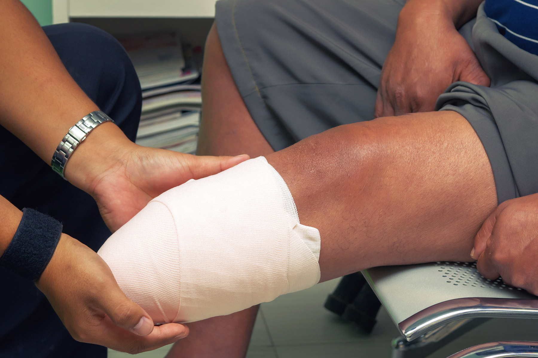 They Lost Their Legs. Doctors and Health Care Giants Profited.